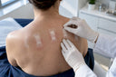 Anonymous adhesive test strips during dermatology testing